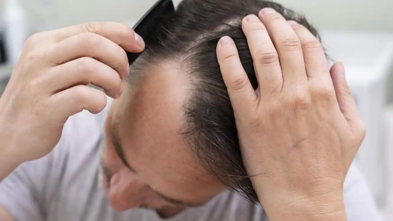 https://www.mobilemasala.com/health-hi/You-should-also-know-some-important-measures-to-manage-and-prevent-hair-fall-hi-i274055